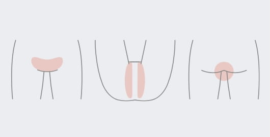 VIOの場所を示したイラスト