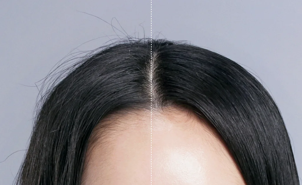 フラットモードのBefore（左）、After（右）を比較した写真